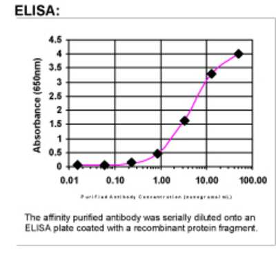ELISA: BRCA1 Antibody [40980002]
