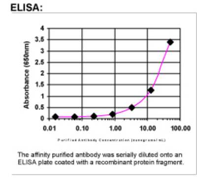 ELISA: EPHA10 Antibody [45320002]