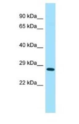 Western Blot: 4930567H17Rik Antibody [NBP1-98255] - Mouse Kiney Lysate 1.0ug/ml, gel concentration 12%