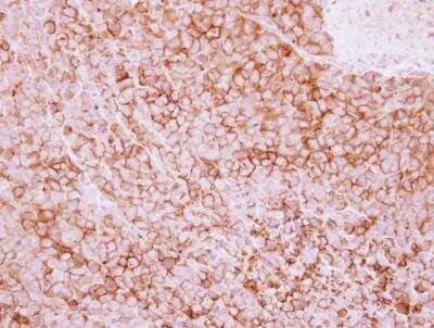 Immunohistochemistry-Paraffin: 5'-Nucleotidase/CD73 Antibody [NBP2-15815] - J5 xenograft, using CD73 antibody at 1:250 dilution. Antigen Retrieval: Trilogy™ (EDTA based, pH 8.0) buffer, 15min.