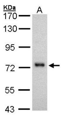 Western Blot: 5'-Nucleotidase/CD73 Antibody [NBP1-32951] - Sample (30 ug of whole cell lysate) A: H1299 7. 5% SDS PAGE; antibody diluted at 1:1000.