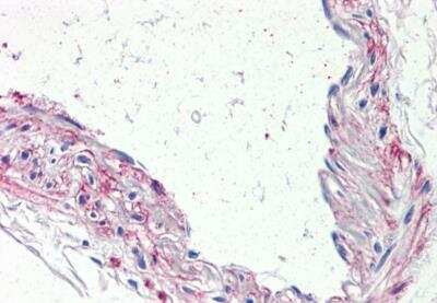 Immunohistochemistry-Paraffin: 5-HT1B Antibody [NBP3-06662] - 5-HT1B Antibody IHC of human vessel. Immunohistochemistry of formalin-fixed, paraffin-embedded tissue after heat-induced antigen retrieval.