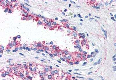 Immunohistochemistry-Paraffin: 5-HT1B Antibody [NBP3-06662] - 5-HT1B Antibody IHC of human prostate. Immunohistochemistry of formalin-fixed, paraffin-embedded tissue after heat-induced antigen retrieval.