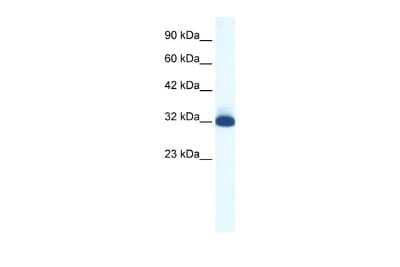 Western Blot: 5-HT1B Antibody [NBP2-86927] - WB Suggested Anti-HTR1B Antibody Titration: 1.25ug/ml. Positive Control: HepG2 cell lysate