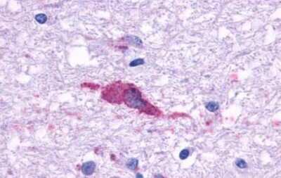 Immunohistochemistry-Paraffin: 5-HT1F Antibody - BSA Free [NBP1-02371] - Brain, Hypothalamus, Supraoptic Nucleus Neuron