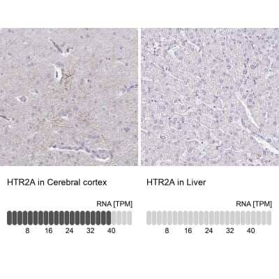 Immunohistochemistry-Paraffin: 5-HT2A Antibody [NBP1-90318] - Analysis in human cerebral cortex and liver tissues. Corresponding 5-HT2A RNA-seq data are presented for the same tissues.