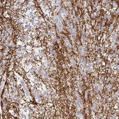 Immunohistochemistry-Paraffin: 5-HT2A Antibody [NBP1-90318] - Staining of human caudate putamen shows moderate membranous positivity in glial cells.