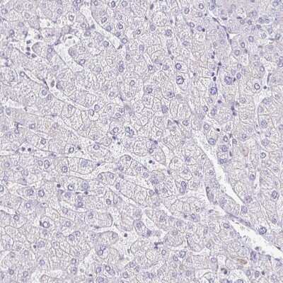 Immunohistochemistry-Paraffin: 5-HT2A Antibody [NBP1-90318] - Staining of human liver shows no membranous positivity in hepatocytes as expected.