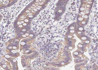 Immunohistochemistry-Paraffin: 5-HT2A Antibody [NBP1-90318] - Staining of human small intestine shows very weak membranous positivity in glanular cells as expected.