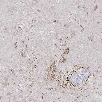 Immunohistochemistry-Paraffin: 5-HT2A Antibody [NBP1-90318] - Staining of human caudate nucleus shows moderate cytoplasmic positivity in neuronal cell bodies and processes.