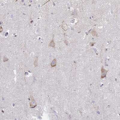Immunohistochemistry-Paraffin: 5-HT2A Antibody [NBP1-90318] - Staining of human cerebral cortex shows moderate cytoplasmic positivity in neurons.