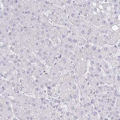 Immunohistochemistry-Paraffin: 5-HT2A Antibody [NBP1-90318] - Staining of human liver shows no positivity in hepatocytes as expected.