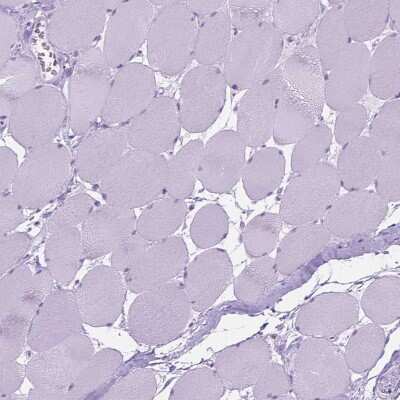 Immunohistochemistry-Paraffin: 5-HT2B Antibody [NBP1-90322] - Staining of human skeletal muscle shows no positivity in myocytes as expected.