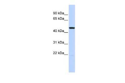 Western Blot: 5-HT3C Antibody [NBP3-10365] - Western blot analysis using NBP3-10365 on Human Brain  as a positive control. Antibody Titration: 0.2-1 ug/ml