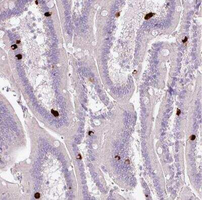 Immunohistochemistry-Paraffin: 5-HT3E Antibody [NBP2-33578] - Staining of human duodenum shows strong cytoplasmic positivity in a subset of glandular cells.