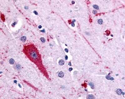 Immunohistochemistry-Paraffin: 5-HT5A Antibody - BSA Free [NB100-58983] - Analysis of anti-5HT5A Receptor antibody with human brain, cortex.