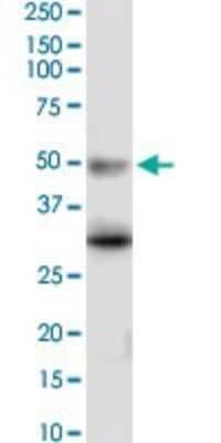 Western Blot: 5-HT5A Antibody (3D1) [H00003361-M02] - HTR5A monoclonal antibody (M02), clone 3D1. Analysis of HTR5A expression in PC-12.