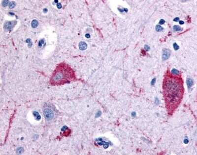 Immunohistochemistry-Paraffin: 5-HT5A Antibody [NB100-58982] - Analysis of anti-5HT5A Receptor antibody with human brain, cortex.