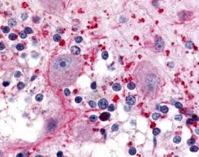 Immunohistochemistry-Paraffin: 5-HT5A Antibody [NB100-59010] - Analysis of anti-5HT5A Receptor antibody with human brain, cerebellum.