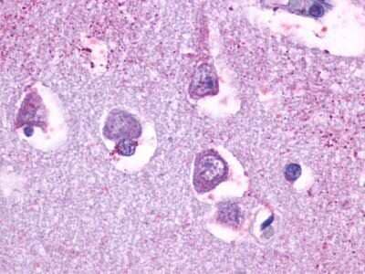 Immunohistochemistry-Paraffin: 5-HT5A Antibody [NLS2121] - Analysis of anti-5HT5A Receptor antibody with human brain, neurons and glia.