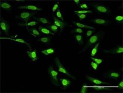 Immunocytochemistry/Immunofluorescence: 5-Lipoxygenase Antibody [H00000240-D01P] - Analysis of antibody to ALOX5 on HeLa cell. Antibody concentration 30 ug/ml.