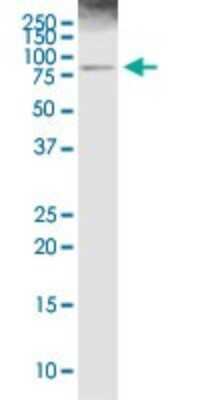 Western Blot: 5-Lipoxygenase Antibody [H00000240-D01P] - Analysis of ALOX5 expression in C32.