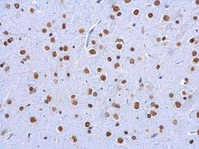 Immunohistochemistry-Paraffin 5-MethylCytosine Antibody (4111)