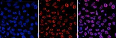 Immunocytochemistry/Immunofluorescence: 5-MethylCytosine Antibody (C.15200003) [NBP2-59166] - HeLa cells were stained with the antibody against 5-mC and with DAPI. Cells were fixed with 4% formaldehyde for 10 minutes and blocked with PBS/Triton X-100 containing 1% BSA. The cells were immunofluorescently labelled with the 5-mC antibody (middle) diluted 1:1000 in blocking solution followed by an anti-mouse antibody conjugated to Alexa594. The left panel shows staining of the nuclei with DAPI. A merge of the two stainings is shown on the right.