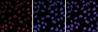 Immunofluorescence: 5-MethylCytosine Antibody (C.15200006) [NBP2-59170] - HeLa cells were stained with the antibody against 5-mC and with DAPI. Cells were fixed with 4% formaldehyde for 10 minutes and blocked with PBS/TX-100 containing 1% BSA. The cells were immunofluorescently labelled with the 5-mC antibody (left) diluted 1:1,000 in blocking solution followed by an anti-mouse antibody conjugated to Alexa Fluor 594. The middle panel shows staining of the nuclei with DAPI. A merge of the two stainings is shown on the right.