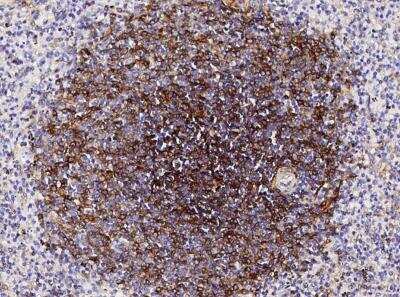Immunohistochemistry-Paraffin: 5'-Nucleotidase/CD73 Antibody (001) [NBP2-89705] - Staining of human NT5E in human spleen with rabbit monoclonal antibody (1:5000).