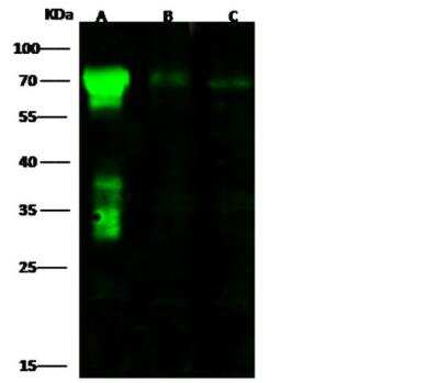 Western Blot: 5'-Nucleotidase/CD73 Antibody (001) [NBP2-89705] - Lane A: NCI-H1299 Whole Cell Lysate Lane B: HepG2 Whole Cell LysateLane C: Hela Whole Cell Lysate Lysates/proteins at 30 ug per lane.Secondary Goat Anti-Rabbit IgG H&L (Dylight800) at 1/10000 dilution.Developed using the Odyssey technique.  Performed under reducing conditions.Predicted band size:63 kDa Observed band size:70 kDa (We are unsure as to the identity of these extra bands.)