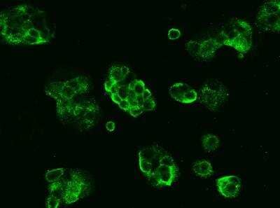 Immunocytochemistry/Immunofluorescence: 5'-Nucleotidase/CD73 Antibody (102) [NBP2-89706] - Staining of NT5E-3 in MCF7 cells. Cells were fixed with 4% PFA,blocked with 10% serum, and incubated with rabbit anti-human NT5E-3 monoclonal antibody (dilution ratio 1:60) at 4c overnight. Then cells were stained with the Alexa Fluor(R)488-conjugated Goat Anti-rabbit IgG secondary antibody (green). Positive staining was localized to Cytoplasm .