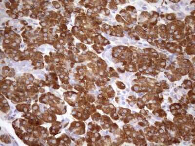 Immunohistochemistry: 5'-Nucleotidase/CD73 Antibody (1G2) [NBP2-46259] - Analysis of Human pancreas tissue. (Heat-induced epitope retrieval by 1mM EDTA in 10mM Tris buffer (pH8.5) at 120C for 3 min)