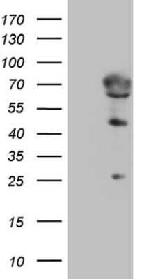 Western Blot: 5'-Nucleotidase/CD73 Antibody (1G2) [NBP2-46259] - Analysis of HEK293T cells were transfected with the pCMV6-ENTRY control (Left lane) or pCMV6-ENTRY 5'-Nucleotidase/CD73.