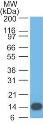 Western Blot: 5'-Nucleotidase/CD73 Antibody (45M3B4) - Azide and BSA Free [NBP2-80551] - Analysis of CD73 in a partial recombinant protein using CD73 antibody at 1 ug/ml. Goat anti-mouse Ig HRP secondary antibody and PicoTect ECL substrate solution were used for this test. Image from the standard format of this antibody.