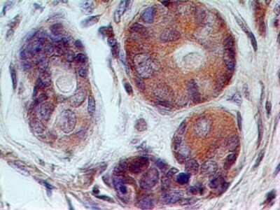 Immunohistochemistry-Paraffin: 5'-Nucleotidase/CD73 Antibody (45M4F9) - Azide Free [NBP2-25243] - Formalin-fixed, paraffin-embedded human breast stained with CD73 antibody (20 ug/ml), peroxidase-conjugate and DAB chromogen.