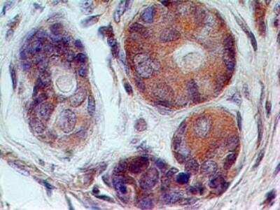 Immunohistochemistry-Paraffin: 5'-Nucleotidase/CD73 Antibody (45M4F9) [NBP2-25237] - Formalin-fixed, paraffin-embedded human breast stained with CD73 antibody (20 ug/ml), peroxidase-conjugate and DAB chromogen.