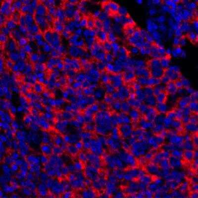 Immunohistochemistry: 5'-Nucleotidase/CD73 Antibody (BLR054F) [NBP3-14679] - FFPE section of human tonsil. Antibody: rabbit anti-CD73 recombinant monoclonal antibody used at 1:250. secondary: HRP- conjugated goat anti-rabbit igG