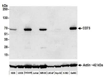 Western Blot: 5'-Nucleotidase/CD73 Antibody (BLR054F) [NBP3-14679] -  FFPE section of IMR-90 cells. Antibody:  Rabbit anti-CD73 recombinant monoclonal antibody  used at 1:100.   HRP-conjugated goat anti-rabbit IgG. 