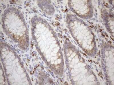 Immunohistochemistry: 5'-Nucleotidase/CD73 Antibody (OTI1G2) - Azide and BSA Free [NBP2-71214] - Analysis of Human colon tissue. (Heat-induced epitope retrieval by 1mM EDTA in 10mM Tris buffer (pH8.5) at 120C for 3 min)