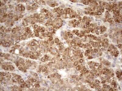 Immunohistochemistry: 5'-Nucleotidase/CD73 Antibody (OTI1G2) - Azide and BSA Free [NBP2-71214] - Analysis of Human liver tissue. (Heat-induced epitope retrieval by 1mM EDTA in 10mM Tris buffer (pH8.5) at 120C for 3 min)