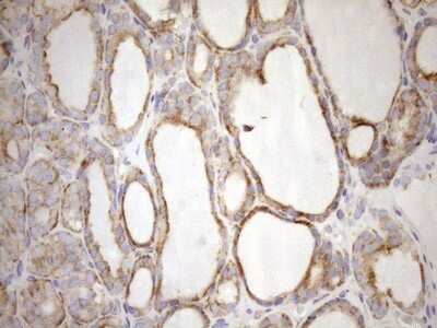 Immunohistochemistry: 5'-Nucleotidase/CD73 Antibody (OTI1G2) - Azide and BSA Free [NBP2-71214] - Analysis of Human thyroid tissue. (Heat-induced epitope retrieval by 1mM EDTA in 10mM Tris buffer (pH8.5) at 120C for 3 min)