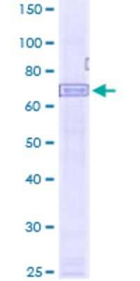 Western Blot: AIM2 Recombinant Protein [H00009447-P01]-12.5% SDS-PAGE Stained with Coomassie Blue. 