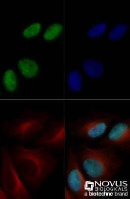 Immunocytochemistry/Immunofluorescence: 53BP1 Antibody (1285C) - Azide and BSA Free [NBP2-80550] - HeLa cells were fixed for 10 minutes using 10% formalin and then permeabilized for 5 minutes using 1X TBS + 0.5% Triton-X100. The cells were incubated with 53BP1 Antibody at 5 ug/ml overnight at 4C and detected with an anti-rabbit Dylight 488 (Green) at a 1:500 dilution. Alpha tubulin (DM1A) (Catalog #NB100-690) was used as a co-stain at a 1:1000 dilution and detected with an anti-mouse Dylight 550 (Red) at a 1:500 dilution. Nuclei were counterstained with DAPI (Blue). Cells were imaged using a 40X objective. Image from the standard format of this antibody.