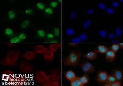 Immunocytochemistry/Immunofluorescence: 53BP1 Antibody (1285C) - Azide and BSA Free [NBP2-80550] - Neuro2a cells were fixed for 10 minutes using 10% formalin and then permeabilized for 5 minutes using 1X TBS + 0.5% Triton-X100. The cells were incubated with 53BP1 Antibody at 5 ug/ml overnight at 4C and detected with an anti-rabbit Dylight 488 (Green) at a 1:500 dilution. Alpha tubulin (DM1A) (Catalog #NB100-690) was used as a co-stain at a 1:1000 dilution and detected with an anti-mouse Dylight 550 (Red) at a 1:500 dilution. Nuclei were counterstained with DAPI (Blue). Cells were imaged using a 40X objective. Image from the standard format of this antibody.