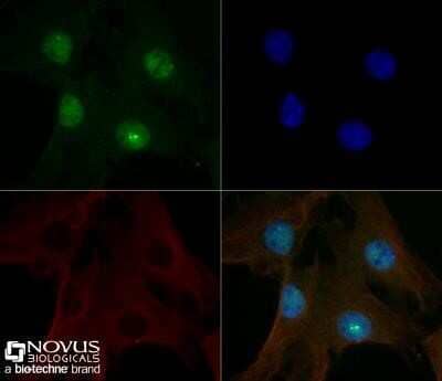 Immunocytochemistry/Immunofluorescence: 53BP1 Antibody (1285C) - Azide and BSA Free [NBP2-80550] - NIH-3T3 cells were fixed for 10 minutes using 10% formalin and then permeabilized for 5 minutes using 1X TBS + 0.5% Triton-X100. The cells were incubated with 53BP1 Antibody at 5 ug/ml overnight at 4C and detected with an anti-rabbit Dylight 488 (Green) at a 1:500 dilution. Alpha tubulin (DM1A) (Catalog #NB100-690) was used as a co-stain at a 1:1000 dilution and detected with an anti-mouse Dylight 550 (Red) at a 1:500 dilution. Nuclei were counterstained with DAPI (Blue). Cells were imaged using a 40X objective. Image from the standard format of this antibody.