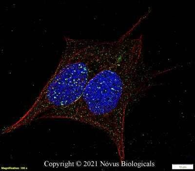 Immunocytochemistry/Immunofluorescence: 53BP1 Antibody (1285C) - Azide and BSA Free [NBP2-80550] - Ntera2 cells were fixed in 4% paraformaldehyde for 10 minutes and permeabilized in 0.5% Triton X-100 in PBS for 5 minutes. The cells were incubated with anti-53BP1 Antibody [1285C] NBP2-80550 at 2 ug/ml overnight at 4C and detected with an anti-rabbit Dylight 488 (Green) at a 1:1000 dilution for 60 minutes.  Alpha tubulin (DM1A) NB100-690 was used as a co-stain at a 1:1000 dilution and detected with an anti-mouse Dylight 550 (Red) at a 1:1000 dilution. Nuclei were counterstained with DAPI (Blue).  Cells were imaged using a 100X objective and digitally deconvolved.