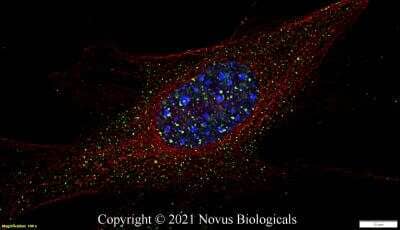 Immunocytochemistry/Immunofluorescence: 53BP1 Antibody (1285C) - Azide and BSA Free [NBP2-80550] - NIH3T3 cells were fixed in 4% paraformaldehyde for 10 minutes and permeabilized in 0.5% Triton X-100 in PBS for 5 minutes. The cells were incubated with anti-53BP1 Antibody [1285C] NBP2-80550 at 2 ug/ml overnight at 4C and detected with an anti-rabbit Dylight 488 (Green) at a 1:1000 dilution for 60 minutes.  Alpha tubulin (DM1A) NB100-690 was used as a co-stain at a 1:1000 dilution and detected with an anti-mouse Dylight 550 (Red) at a 1:1000 dilution. Nuclei were counterstained with DAPI (Blue).  Cells were imaged using a 100X objective and digitally deconvolved.