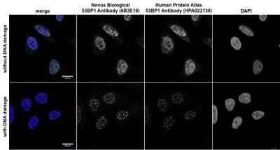 Immunocytochemistry/Immunofluorescence: 53BP1 Antibody (6B3E10) - Azide and BSA Free [NBP2-80549] - Staining of human U-2 OS cells using anti-53BP1 antibody. Bottom images: human U-2 OS cells were treated with EPE to induce DNA-damage and showed increase in nuclear spots after the induction of DNA damage with EPE. Image from verified customer review. Image from the standard format of this antibody.