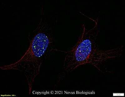 Immunocytochemistry/Immunofluorescence: 53BP1 Antibody (6B3E10) - Azide and BSA Free [NBP2-80549] - Ntera2 cells were fixed in 4% paraformaldehyde for 10 minutes and permeabilized in 0.5% Triton X-100 in PBS for 5 minutes. The cells were incubated with anti-53BP1 Antibody [6B3E10] NBP2-80549 at 2 ug/ml overnight at 4C and detected with an anti-mouse DyLight 488 (Green) at a 1:1000 dilution for 60 minutes.  Beta tubulin NB600-936 was used as a co-stain at a 1:1000 dilution and detected with an anti-rabbit DyLight 550 (Red) at a 1:1000 dilution. Nuclei were counterstained with DAPI (Blue).  Cells were imaged using a 100X objective and digitally deconvolved.